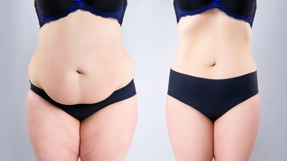 Split image of a woman's torso; the left side shows a larger body with visible belly fat wearing a black panty and blue lace bra, while the right side shows a slimmer body with a flat stomach wearing the same underwear set.