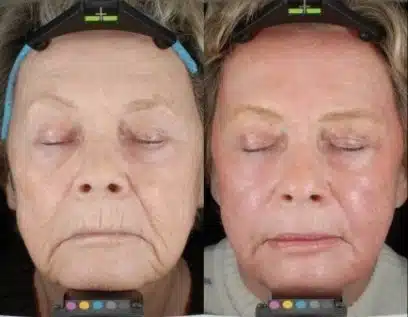 Patient before & after results.