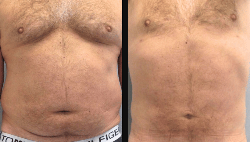 Sin título (850 x 465 px) (820 x 465 px) (2)